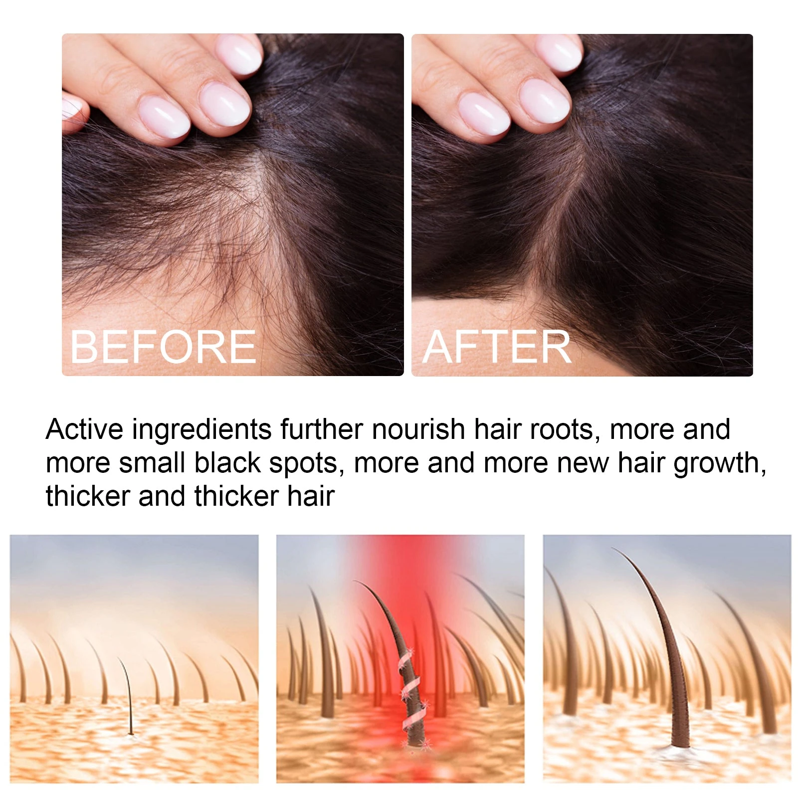 EELHOE Ginger Root Oil For Hair — Hair-parting photographs and scalp-care artwork.