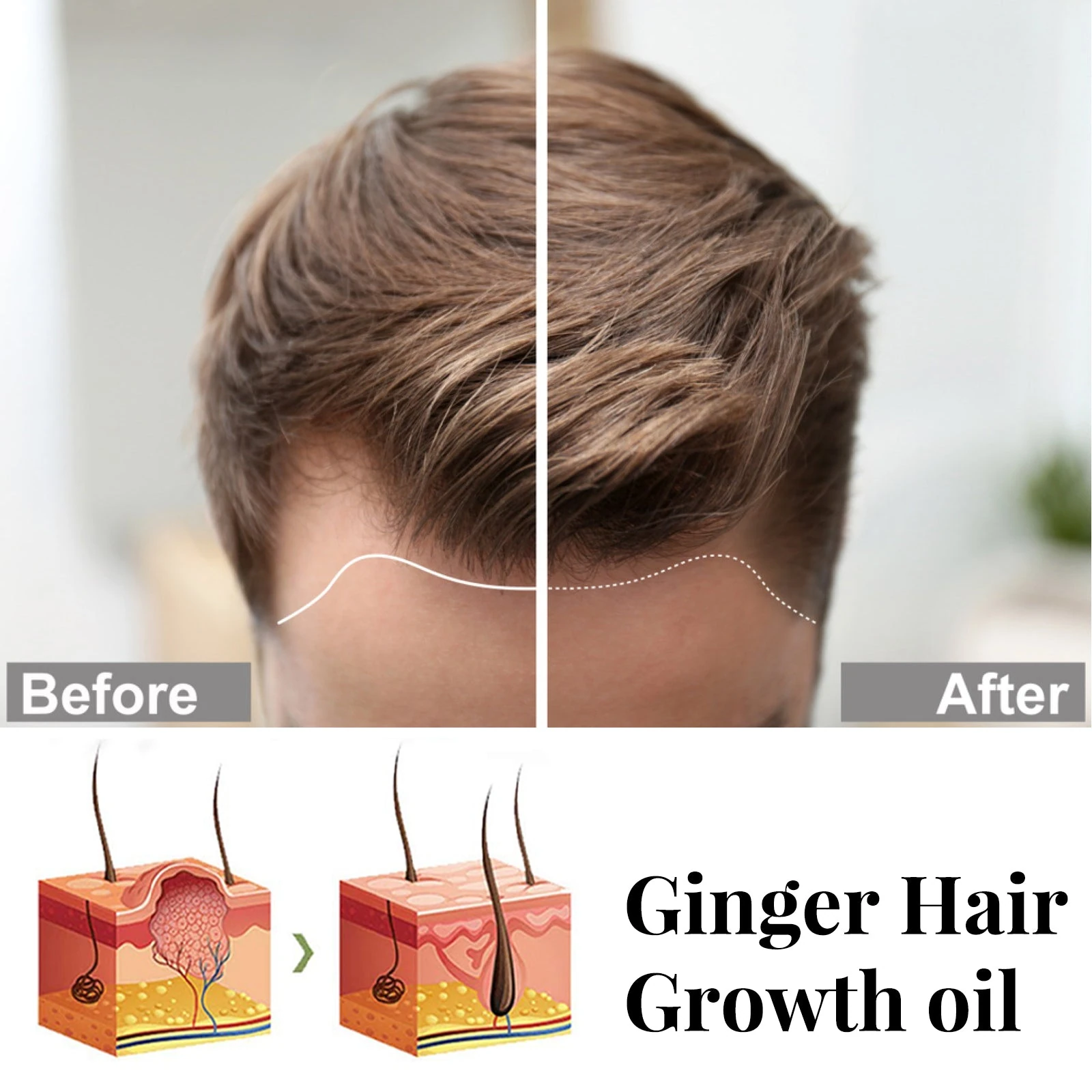EELHOE Ginger Root Oil For Hair — Hairline photographs and root illustration.