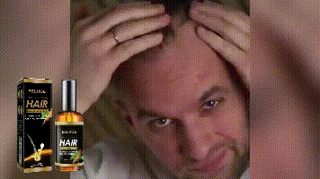 EELHOE Ginger Root Oil For Hair — Animated root-care and hair illustration.