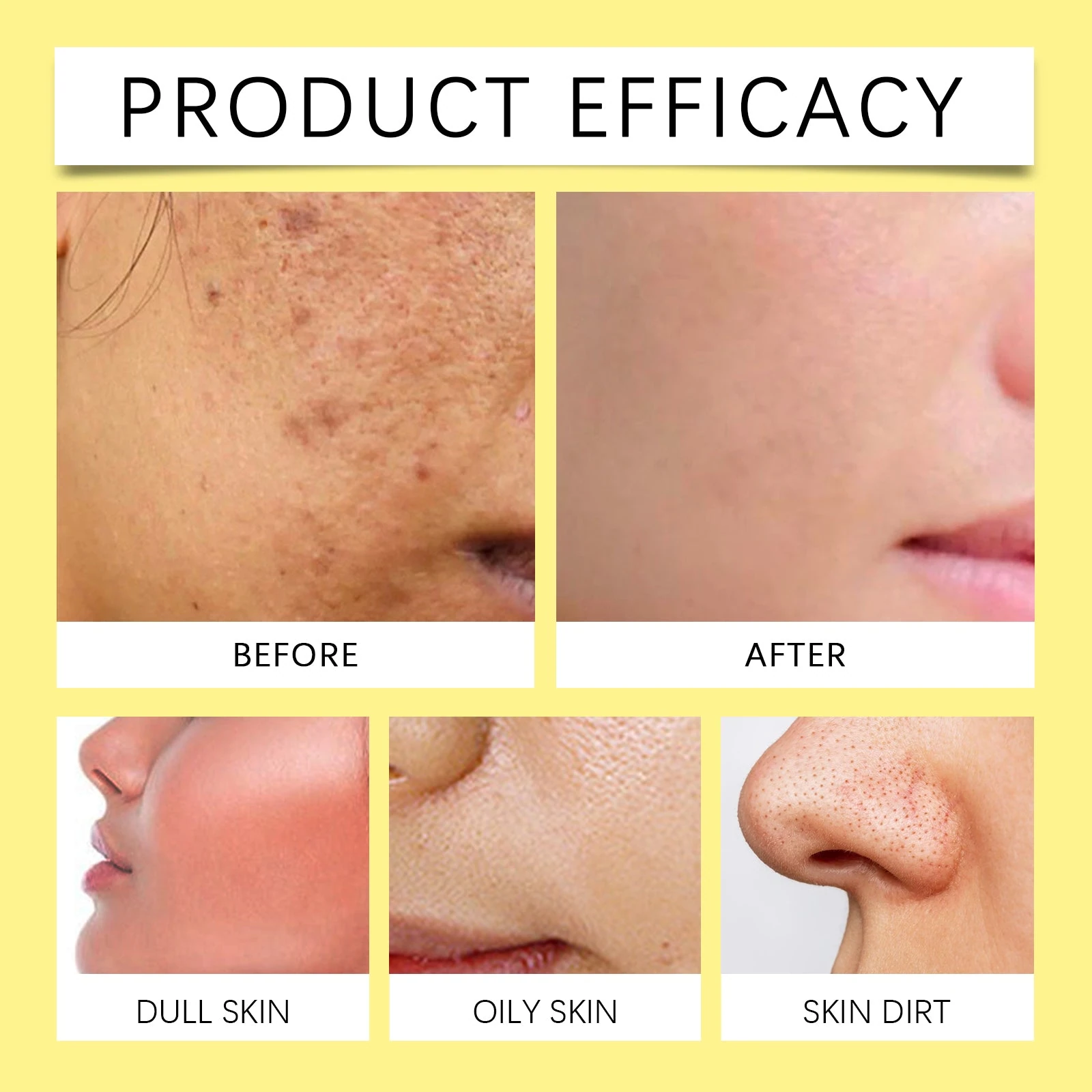 Cleansing-pad illustration showing dullness, surface oil and facial residue