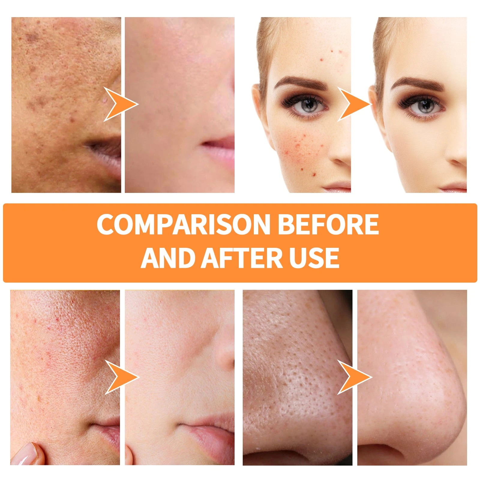 EELHOE Clay Mask Stick — Facial skin-texture comparison artwork.