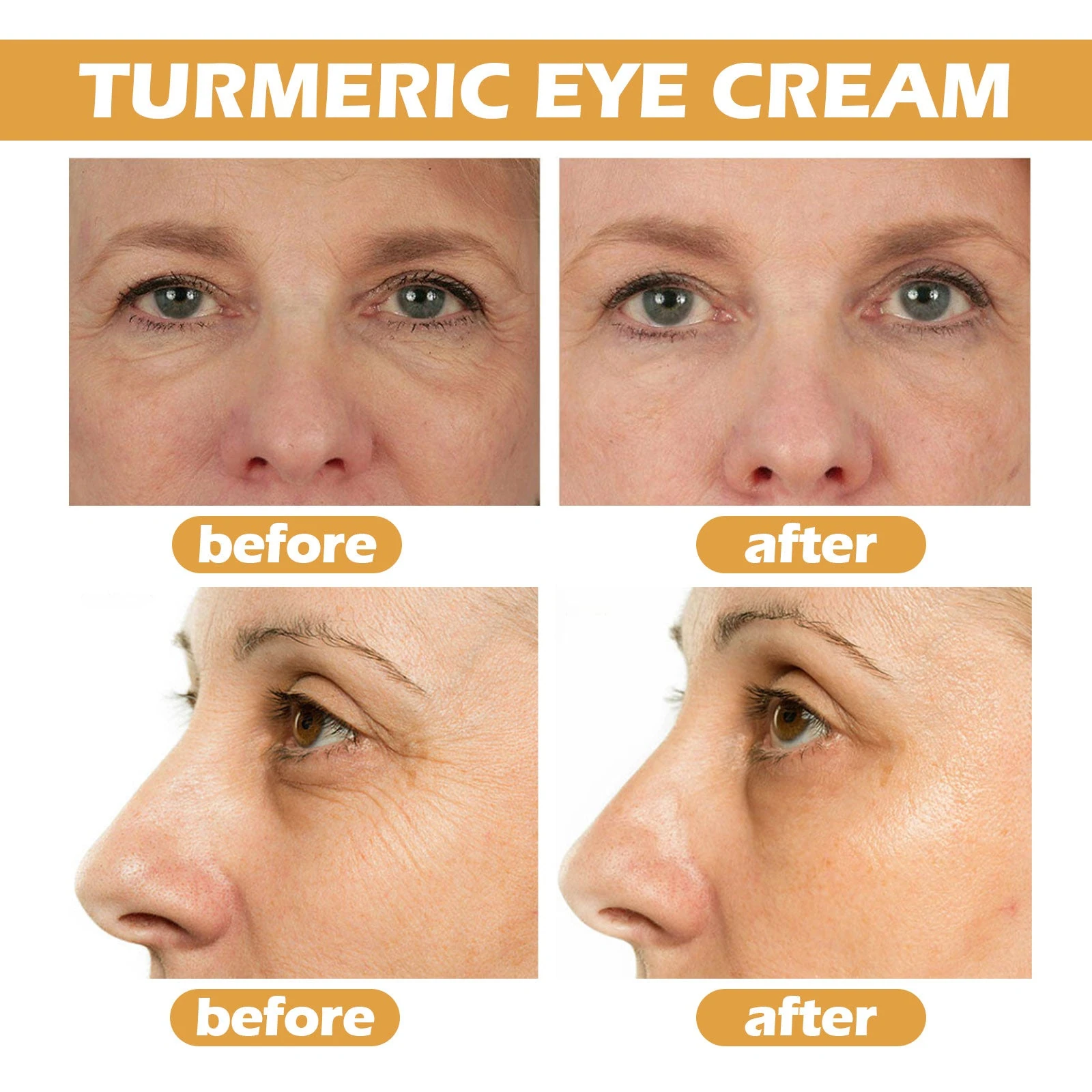 EELHOE Turmeric Eye Cream — Original comparison photographs illustrate eye-area appearance concerns.