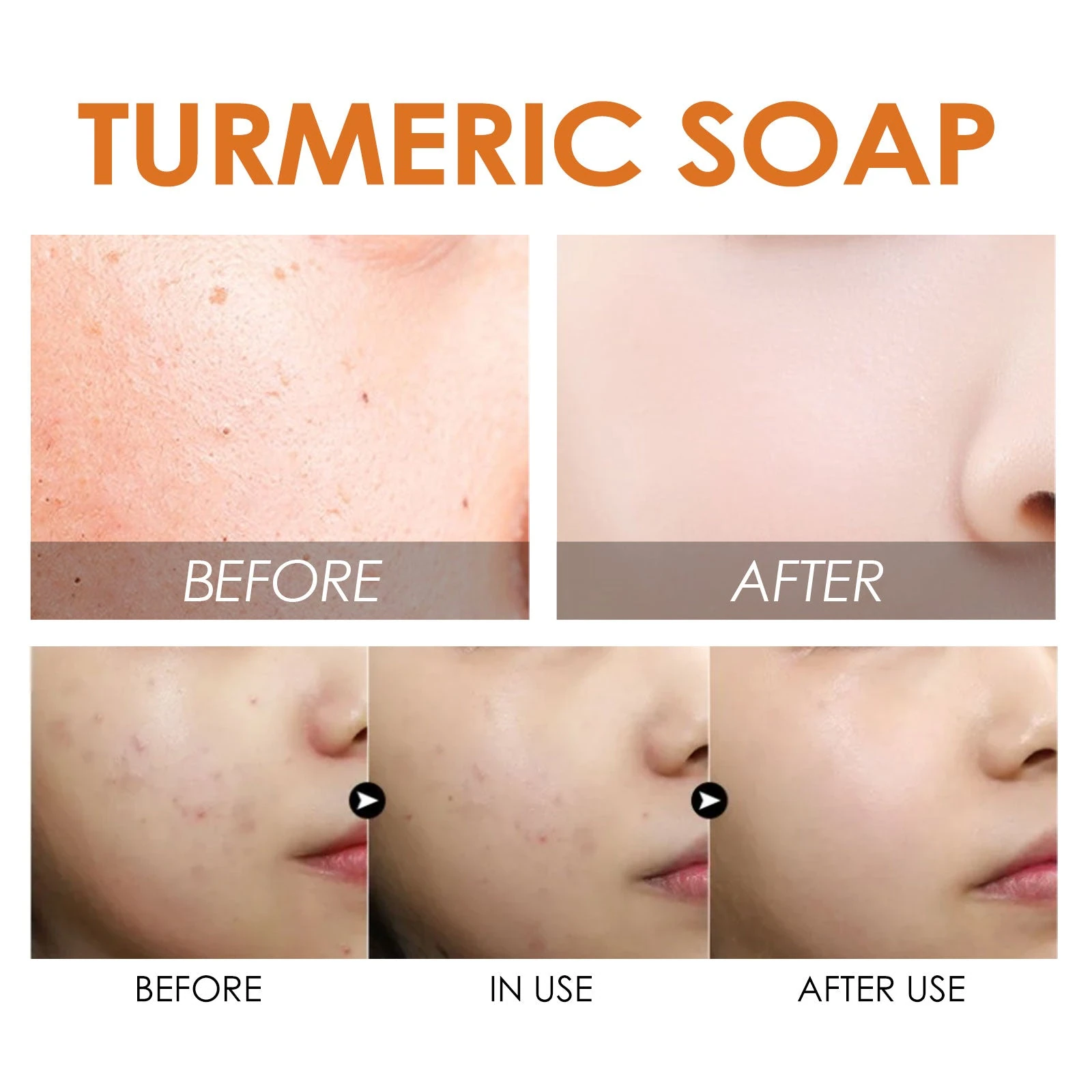 EELHOE Turmeric Soap For Face — Facial skin-texture comparison artwork.
