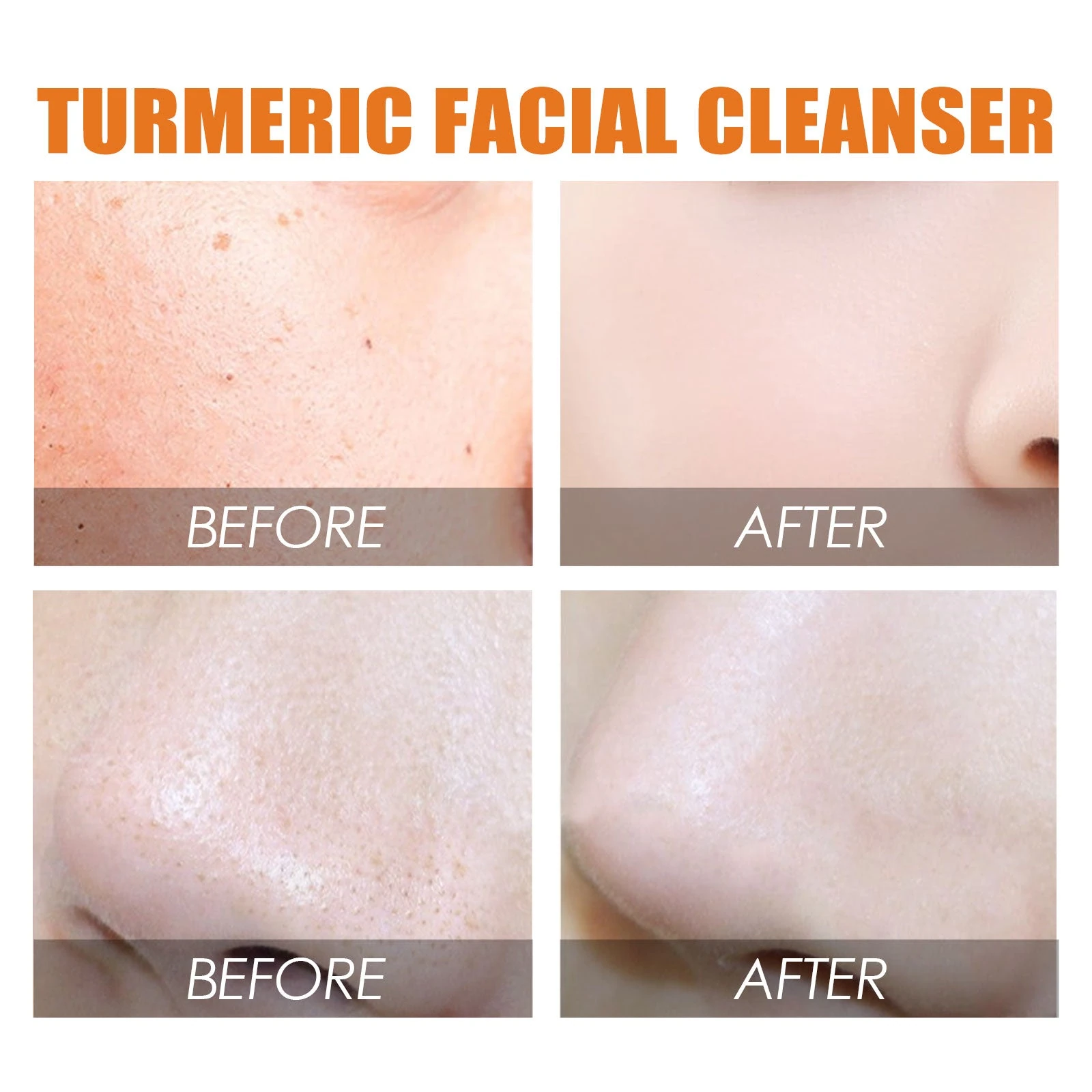 EELHOE Moisturizing Cleanser — Facial skin-texture comparison artwork.