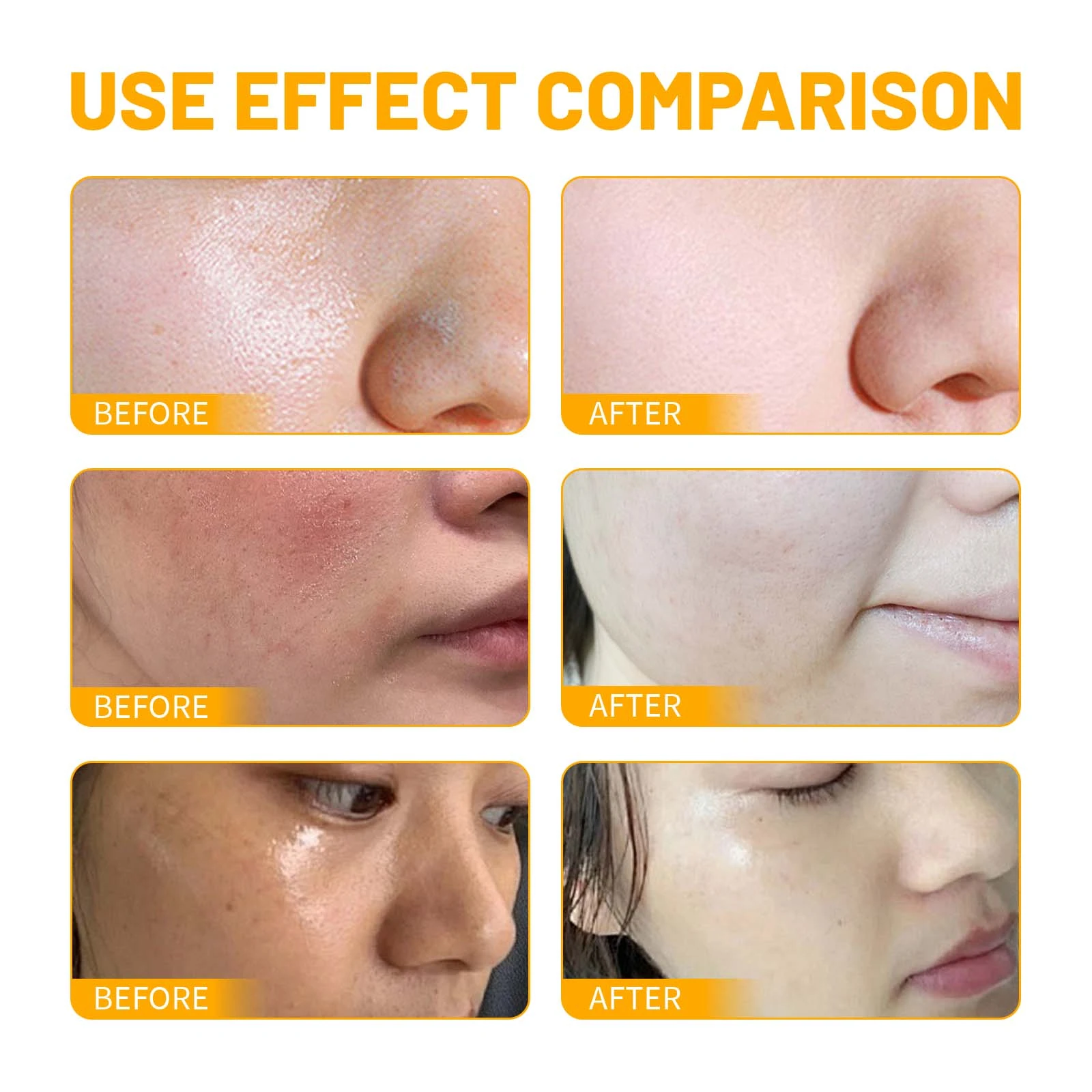 EELHOE Turmeric Face Wash — Facial skin-texture comparison illustration.