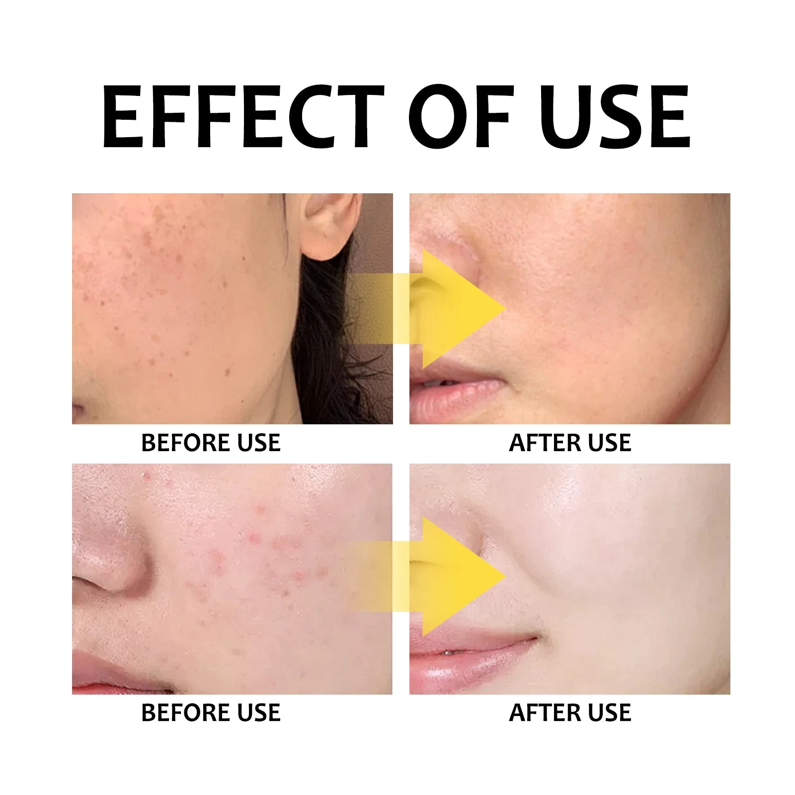 Facial skin appearance artwork accompanying the cleansing routine