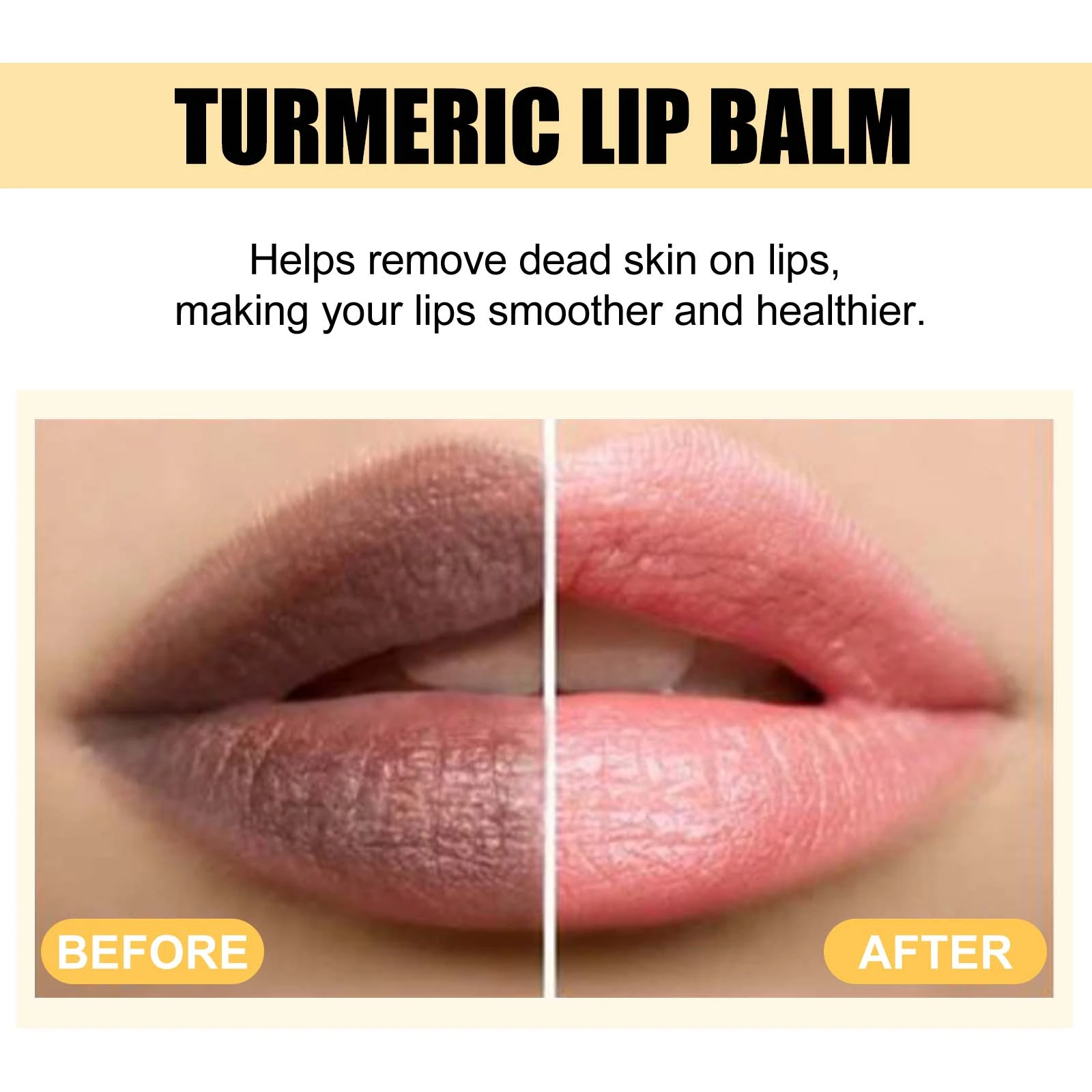 EELHOE Turmeric Lip Balm — Lip surface-texture comparison artwork.