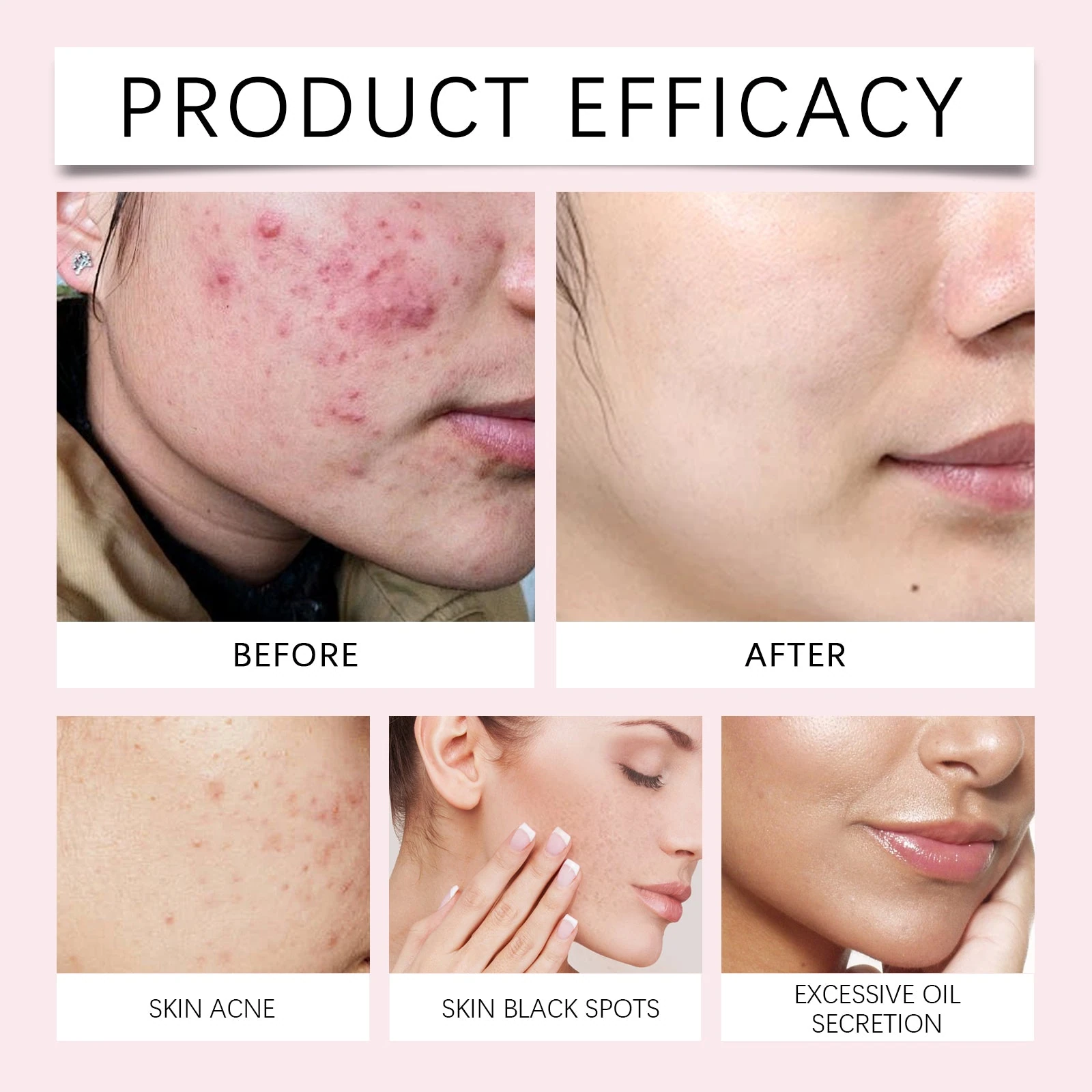 Product artwork showing facial skin concerns including dullness and surface oil