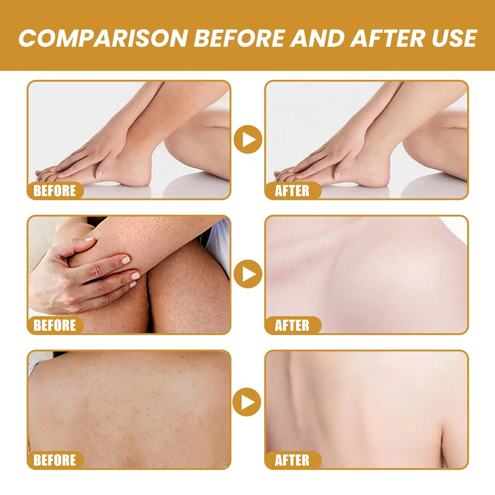 EELHOE Turmeric Body Scrub — Body skin-texture comparison artwork.