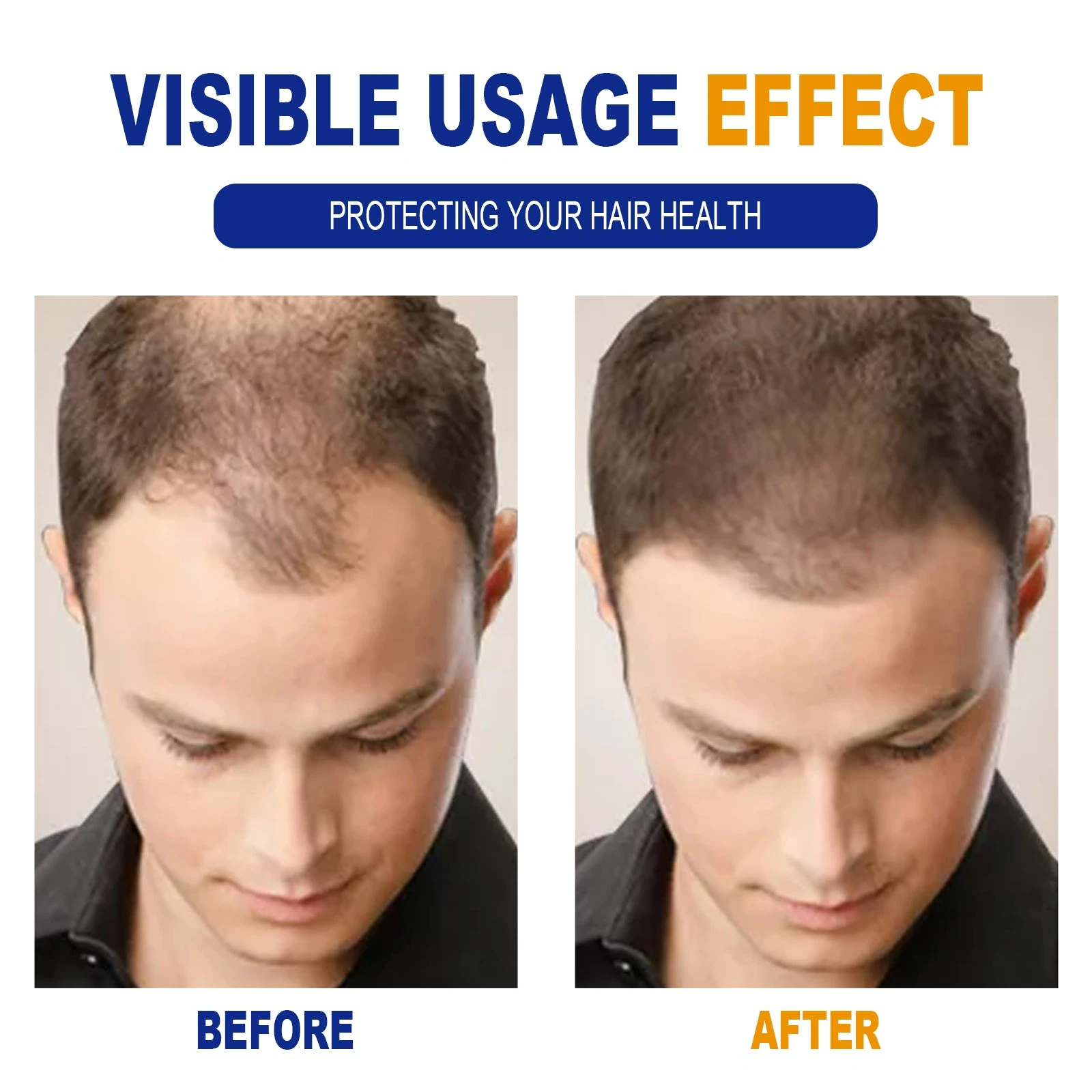 EELHOE Cream Shampoo — Product hairline comparison photographs.