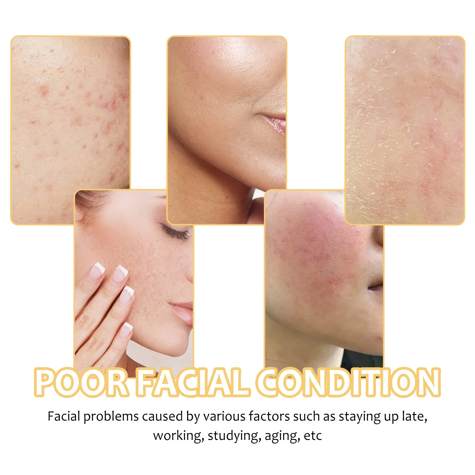 Illustration of facial surface texture and areas that may need gentle cleansing