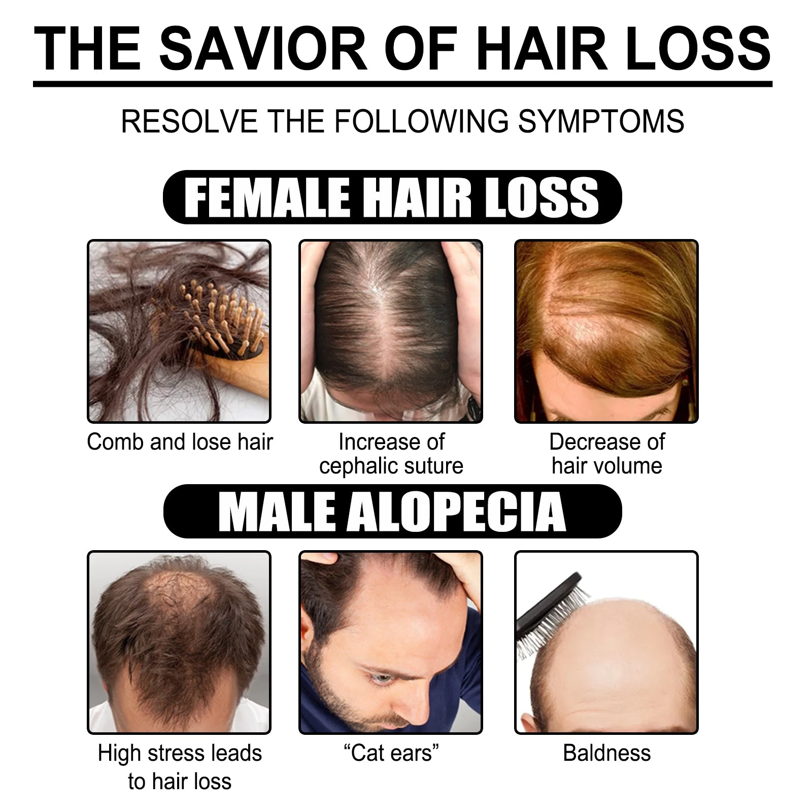 EELHOE Hair thinning concerns illustration