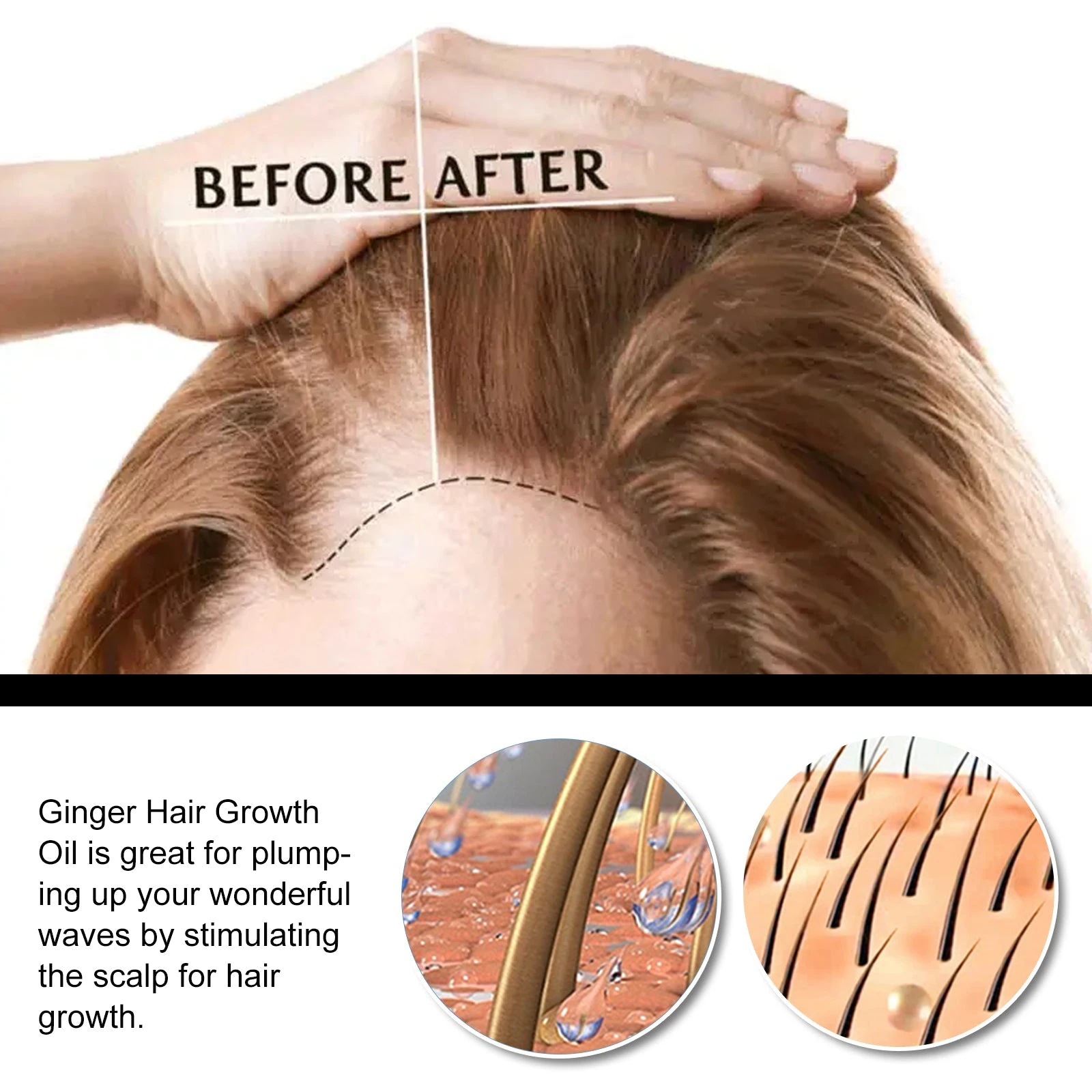 EELHOE Ginger Root Oil For Hair — Hairline and scalp illustration.