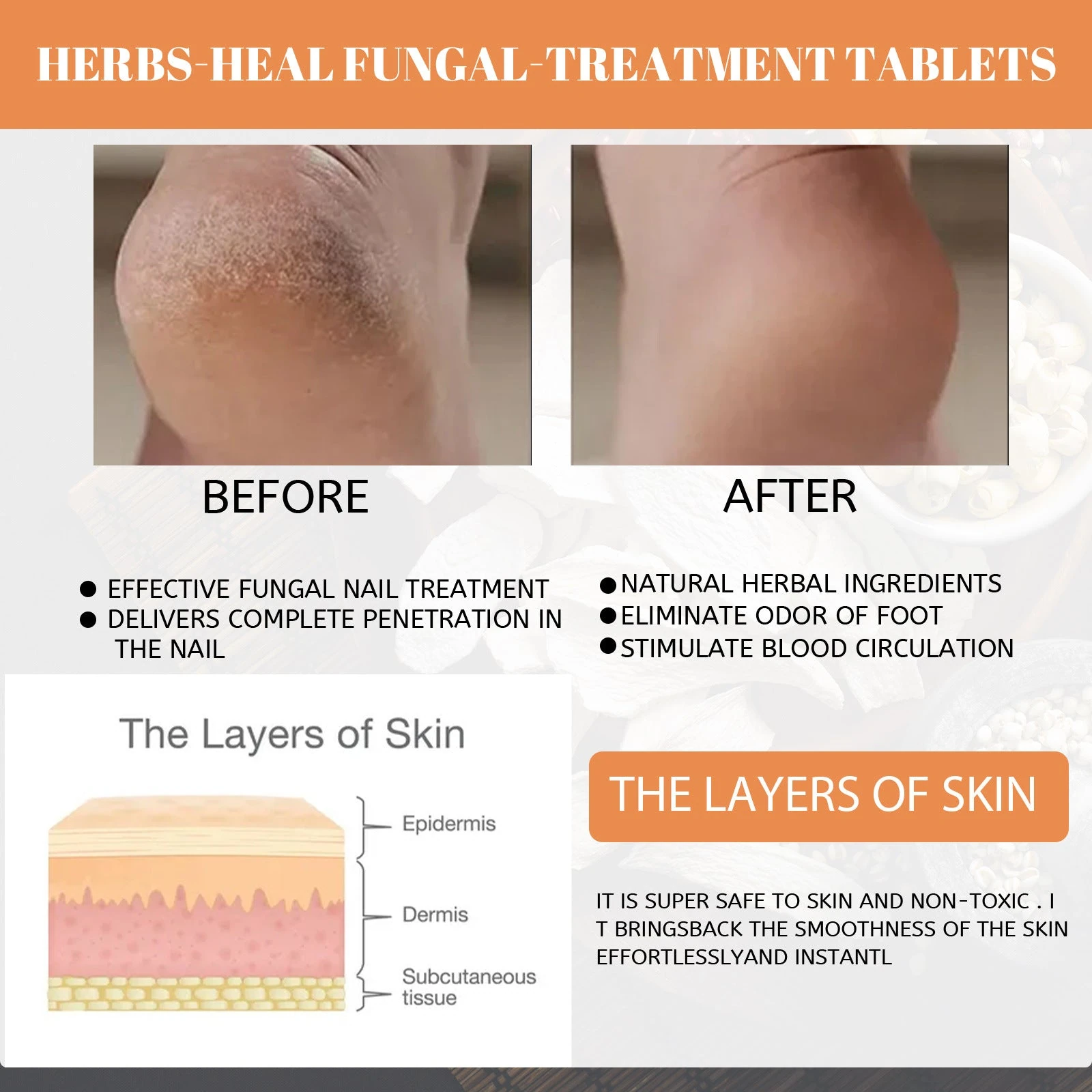 EELHOE Ginger Foot Bath — foot-care artwork with heel photographs.