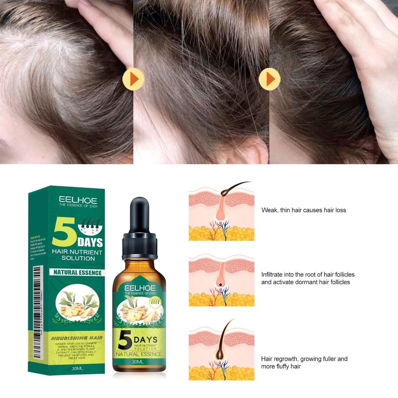 Ginger root oil with scalp, hair follicle and hairline illustrations