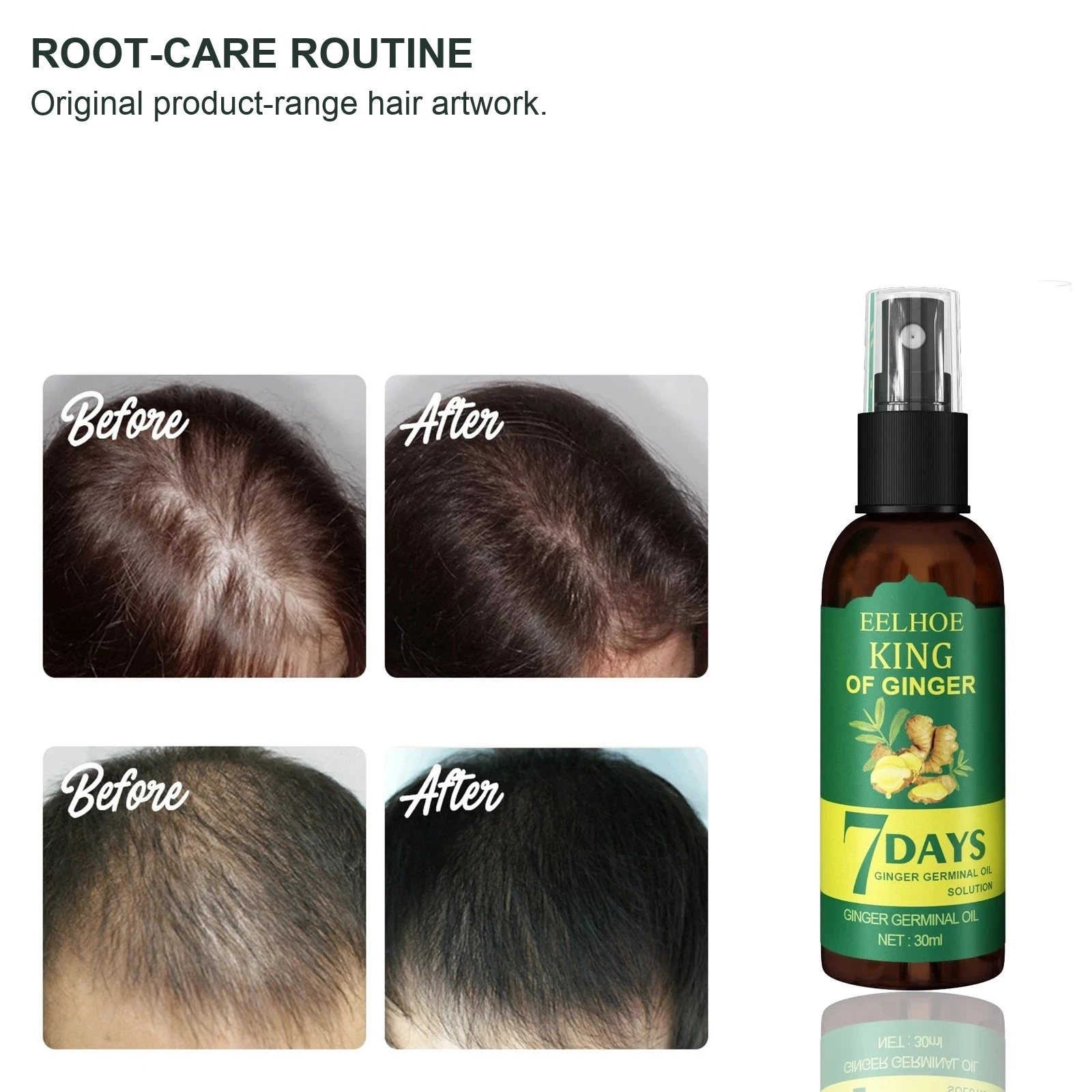 EELHOE Scalp Spray — hair comparison artwork from the product range.