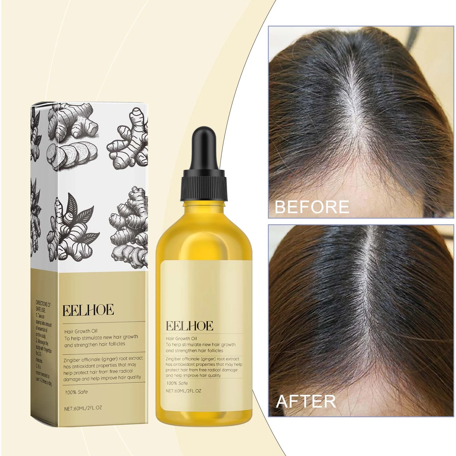 EELHOE Ginger Oil For Hair — Hair-parting comparison artwork beside the oil bottle.