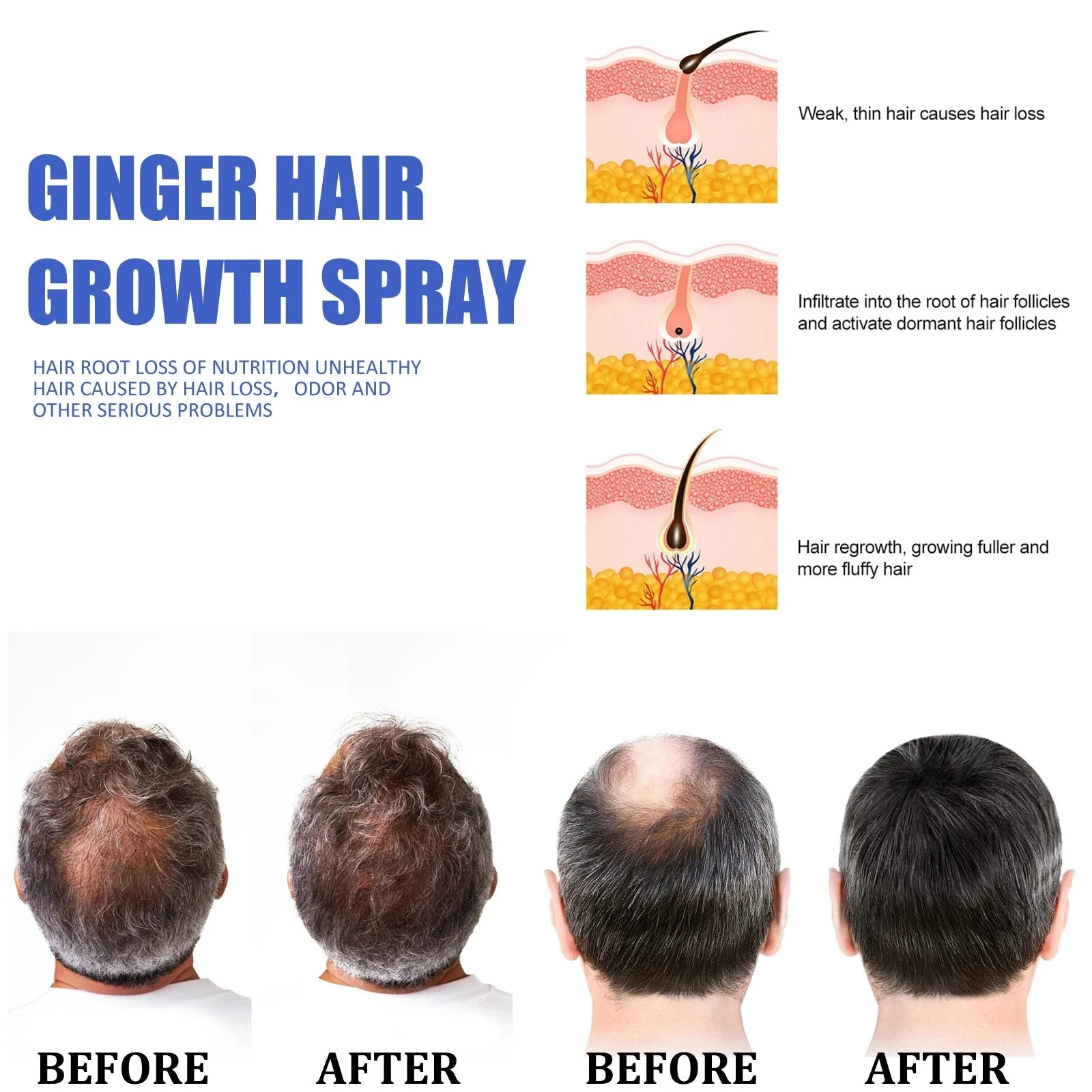 ginger spray artwork showing hair-density comparisons