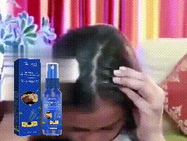 EELHOE Hair Growth Spray For Thinning Hair — Animated scalp-directed spray demonstration.