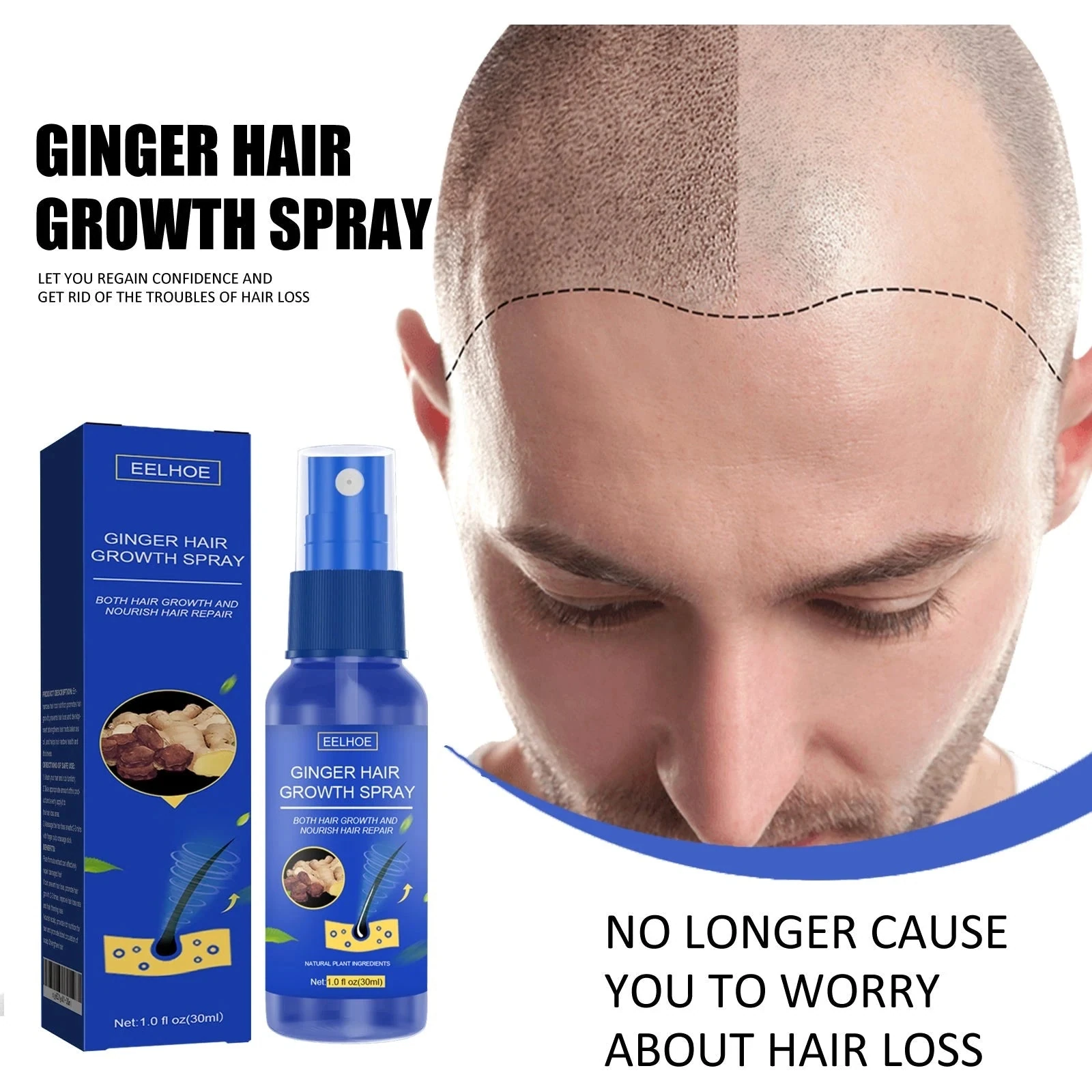 EELHOE Hair Growth Spray For Thinning Hair — Hairline-care artwork alongside the blue spray.
