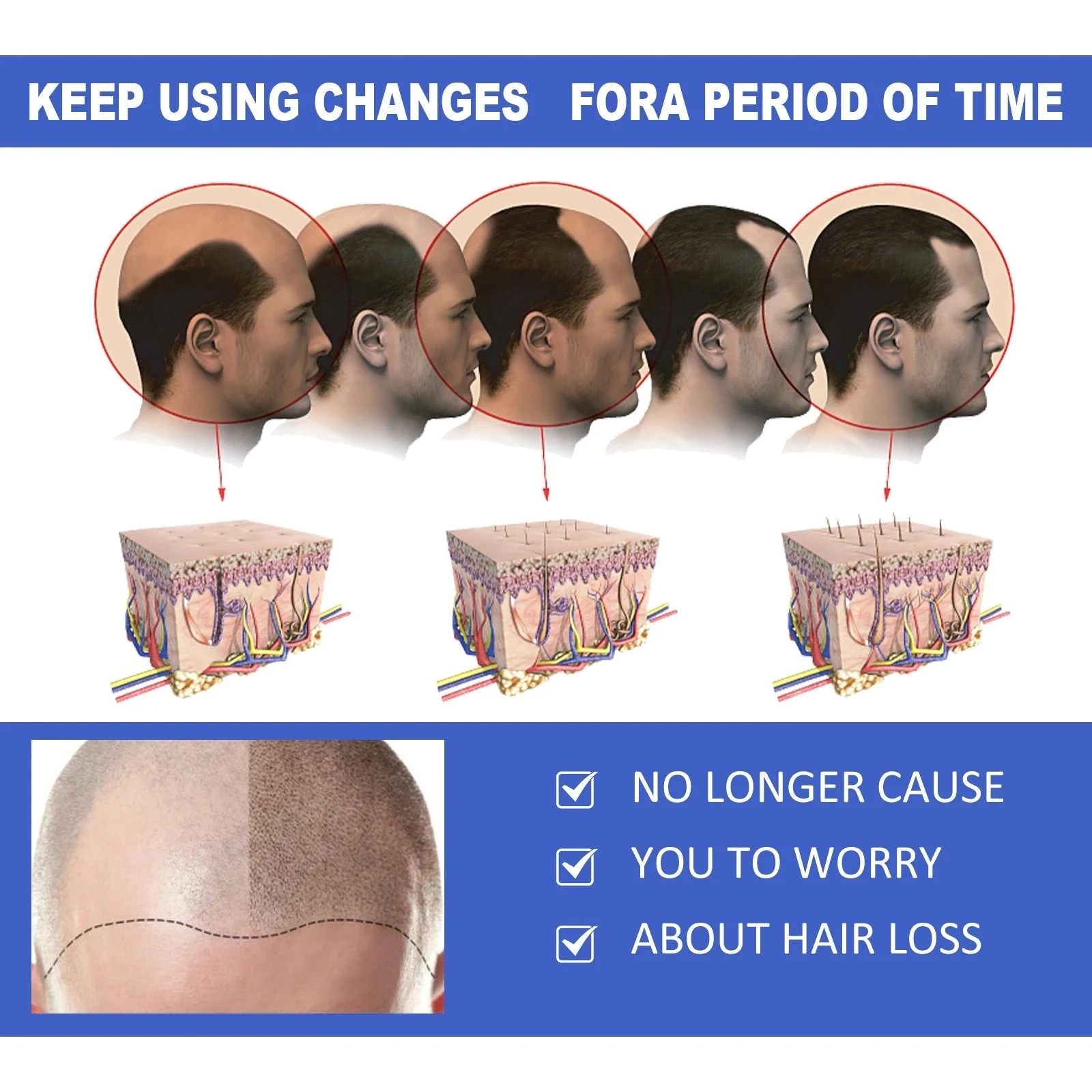 EELHOE Hair Growth Spray For Thinning Hair — Illustrated hair and scalp-care concept.