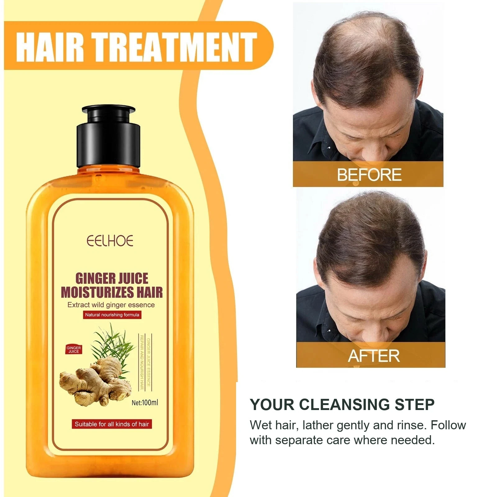 EELHOE Ginger Shampoo — Use shampoo for the cleansing step before leave-in scalp care.