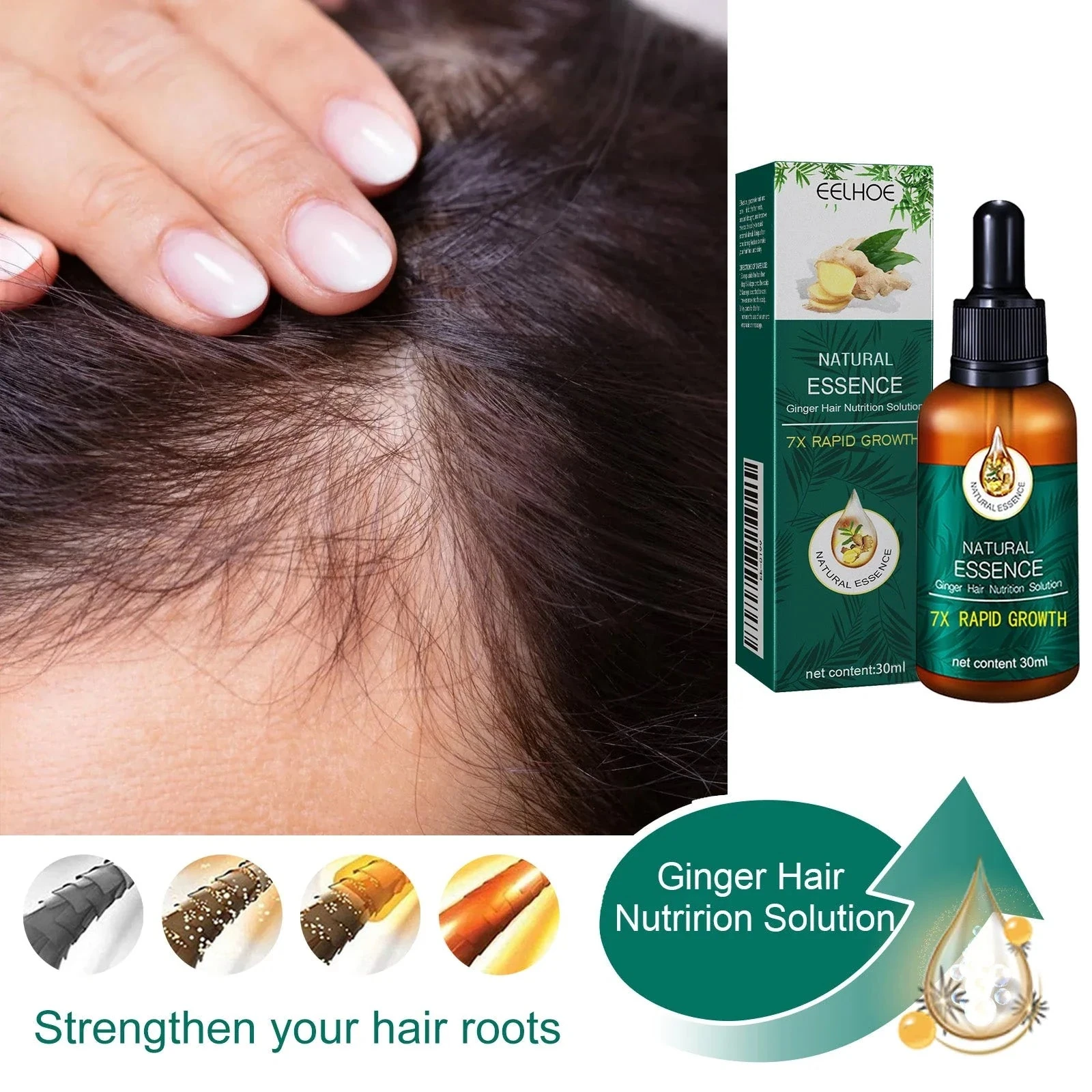 EELHOE ginger oil dropper bottle beside a close-up of parted scalp