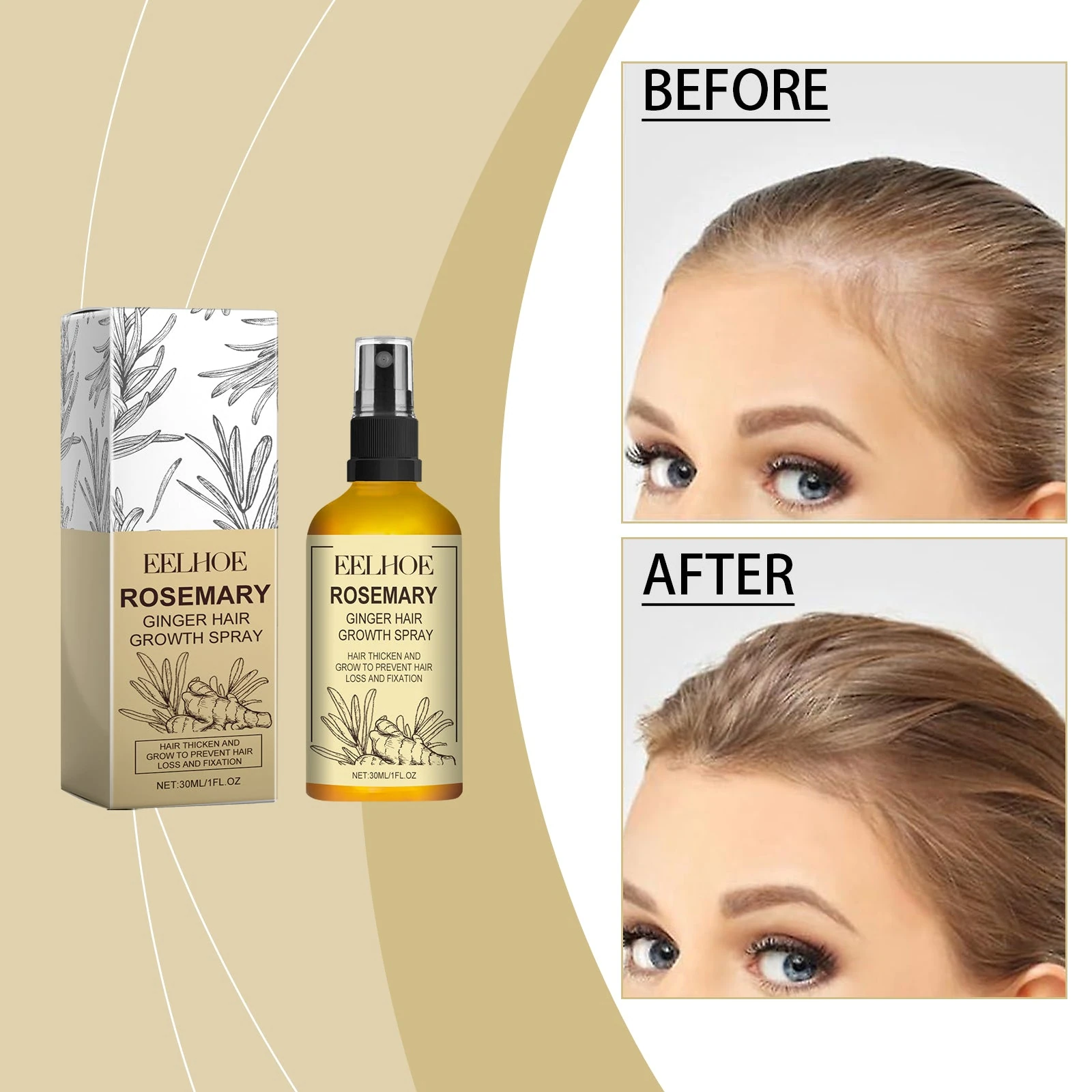Rosemary ginger spray with hairline comparison photographs