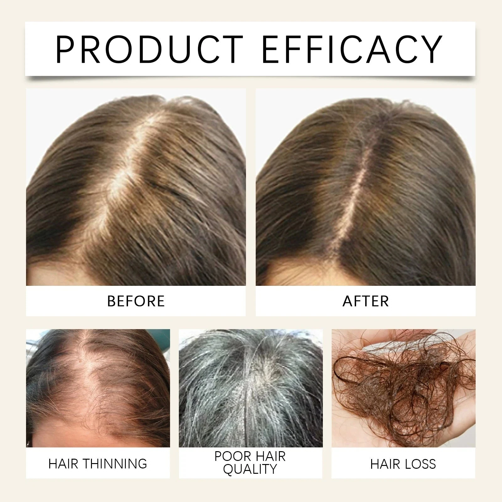 EELHOE Rosemary Hair Oil — hair-parting and texture artwork.