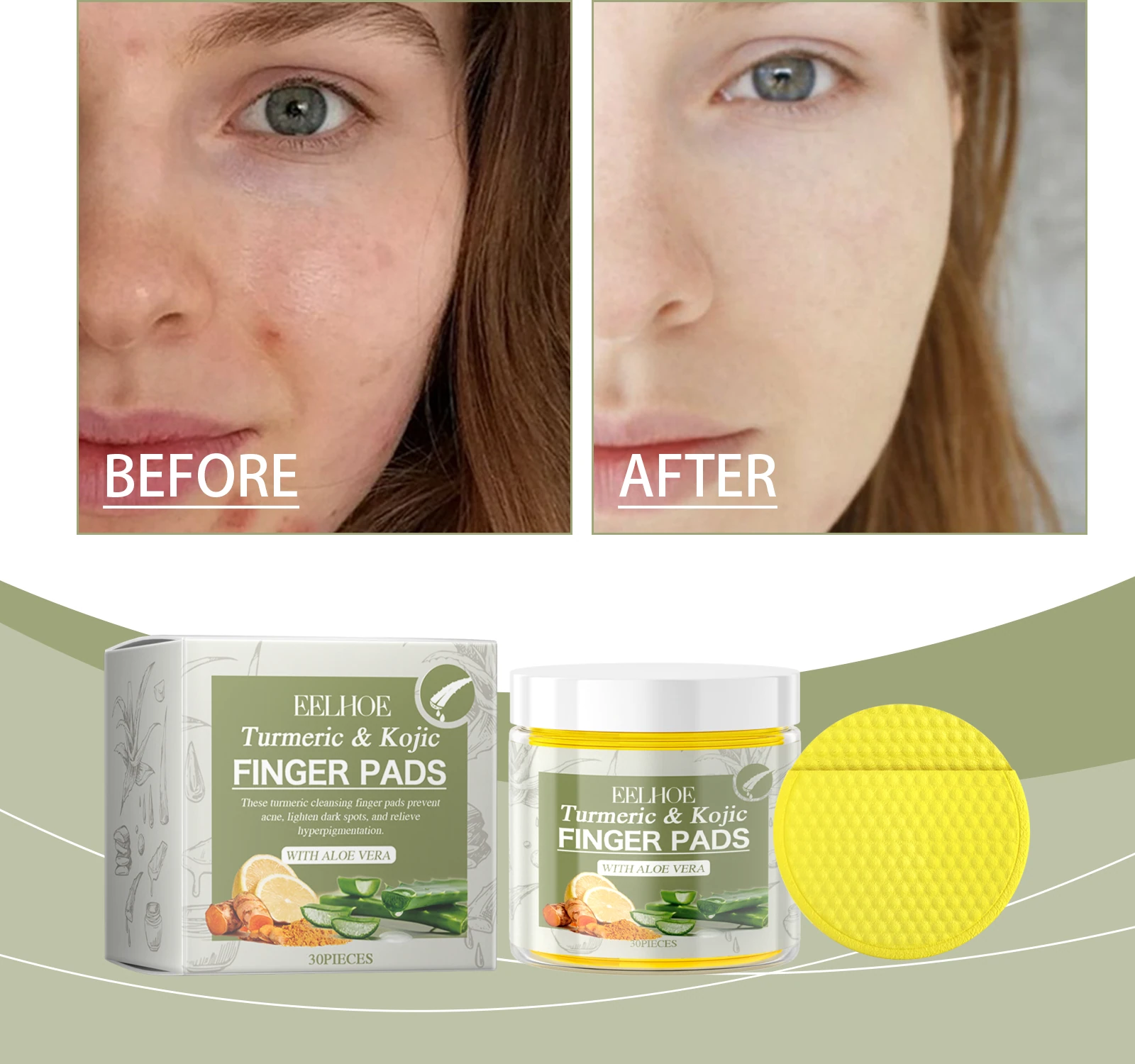 Facial comparison photographs beside turmeric pad jar and carton