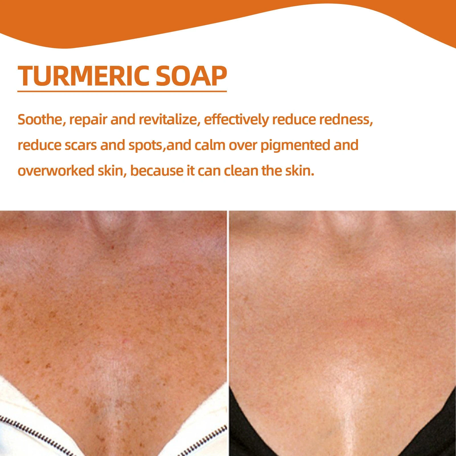 Facial skin comparison photographs in turmeric soap artwork
