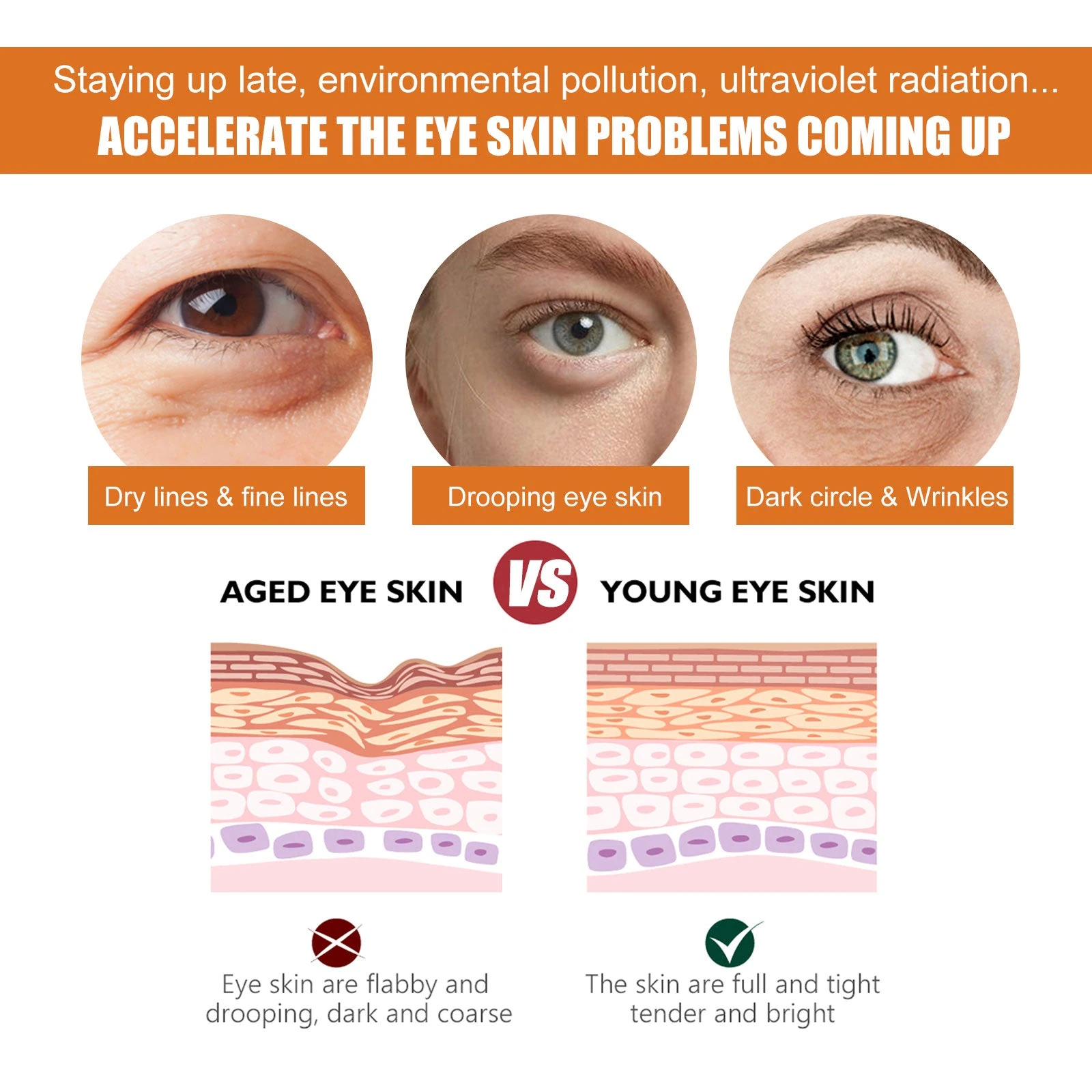 Illustration of eye-area dryness, fine lines and skin texture