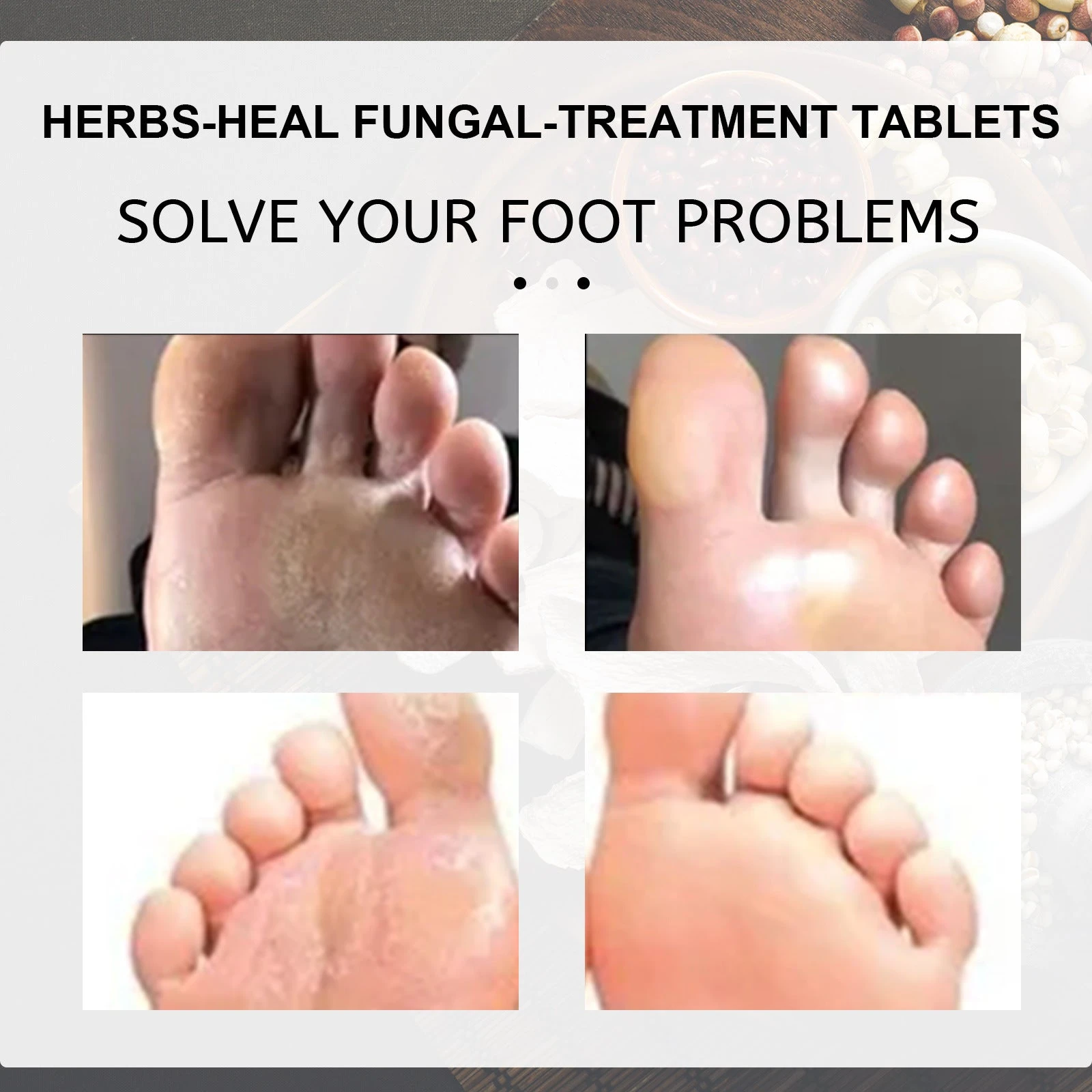 EELHOE Ginger Foot Bath — Product artwork showing rough-looking foot skin.